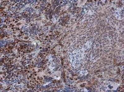 Immunohistochemistry-Paraffin: PDCD4 [p Ser457] Antibody [NBP3-13143]